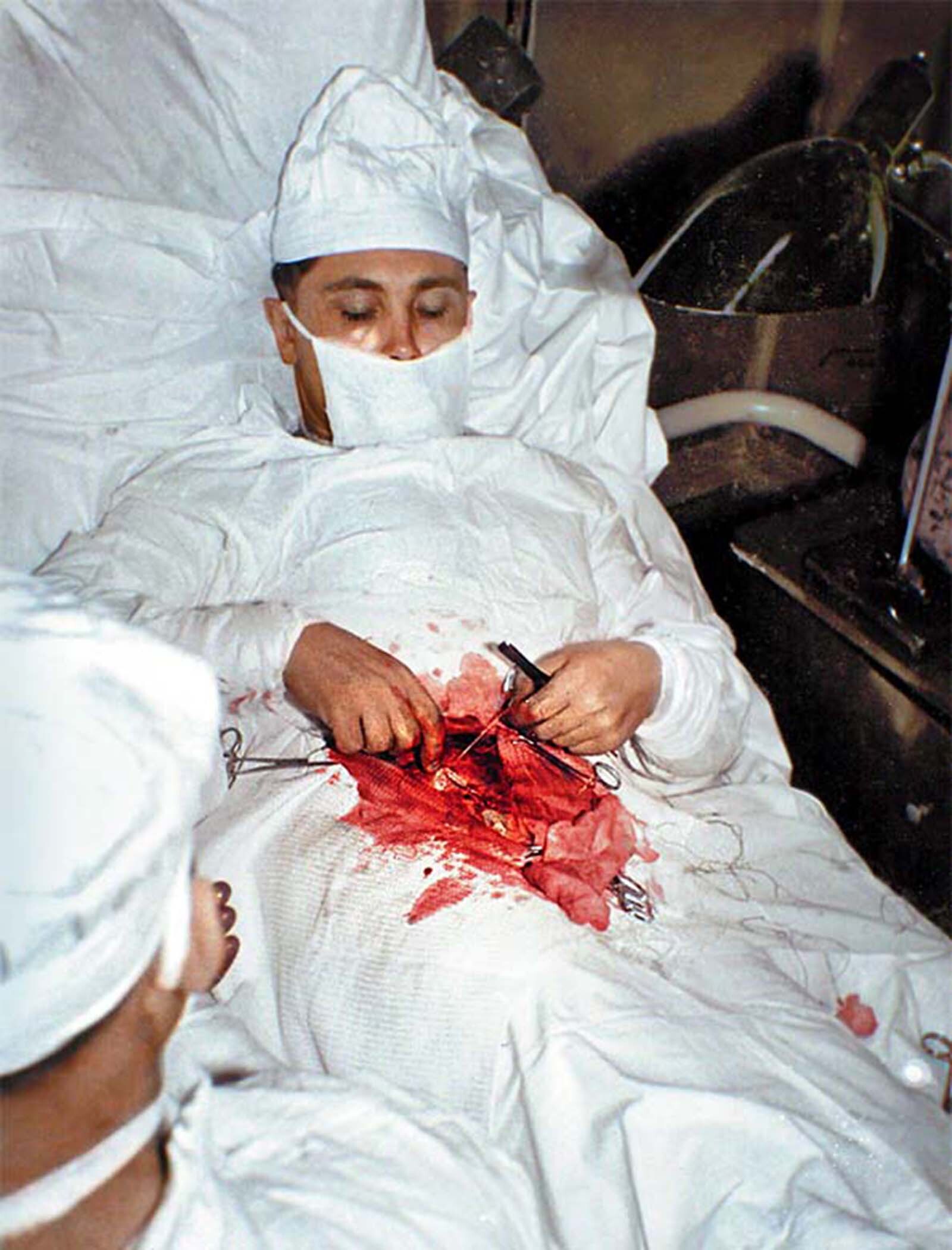 Dr Leonid Rogozov the surgeon who removed his own appendix 1