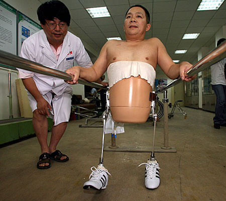 Story of Peng Shuilin Man with only half a body 2