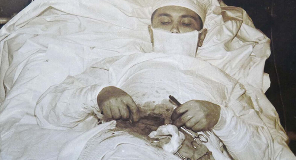 Dr. Leonid Rogozov: the surgeon who removed his own appendix.