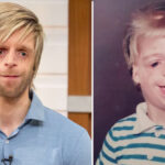 Inspiring story of Jono Lancaster, Abandoned by His mother at birth for this 'defect' on his face