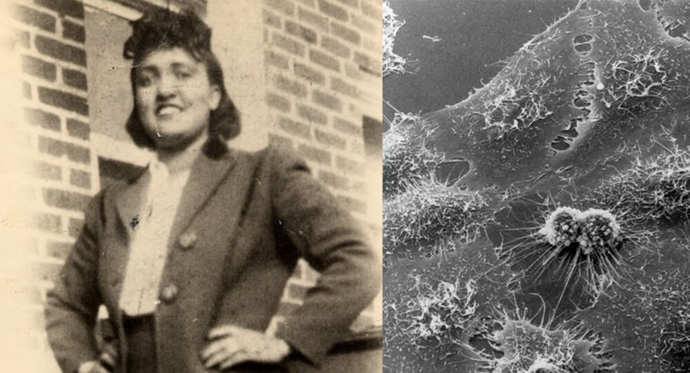 Henrietta Lacks: Who Was She? Here's how HeLa cells became necessary for medical research
